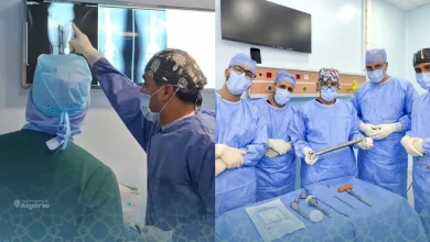 L’EHU d’Oran réalise une prouesse médicale rare sur une patiente de 21 ans 18 Oran